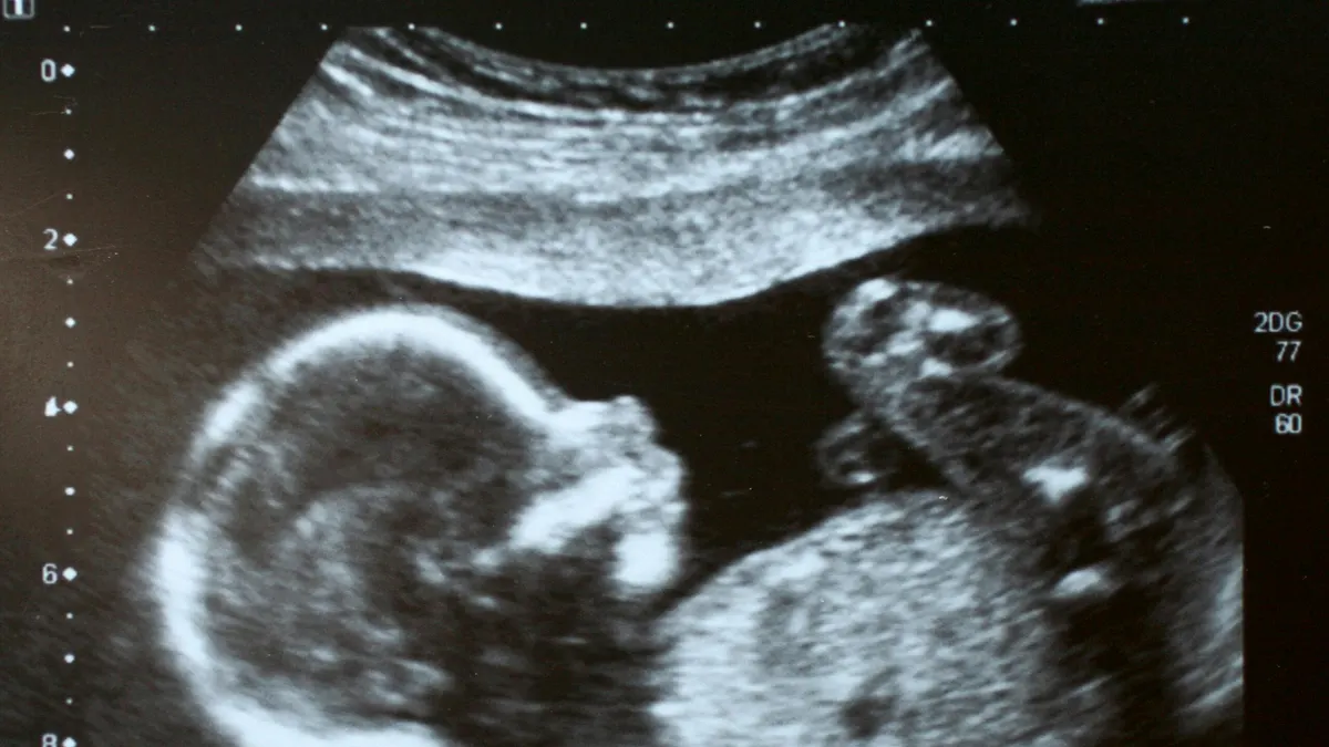 California’s Misguided Attack Against Abortion Pill Reversal