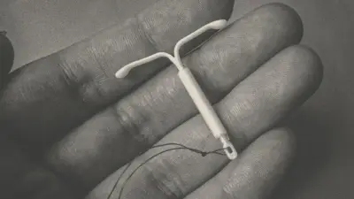 Did My IUD Make My Depression Worse?